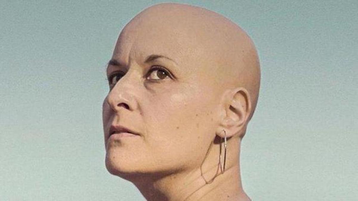 Mujeres Calvas: el documental que rompe tabúes sobre la alopecia femenina